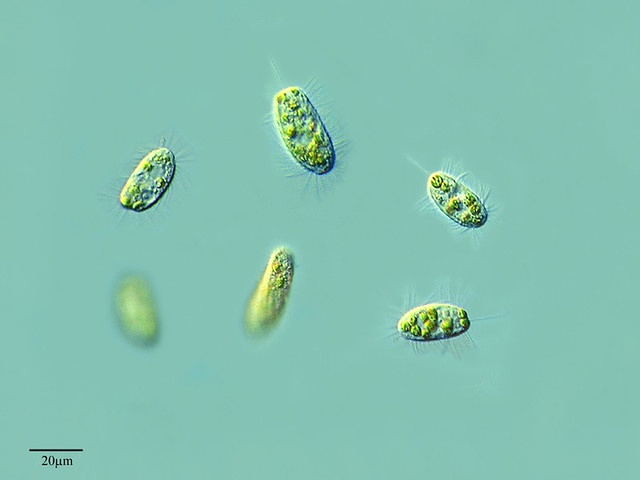 Да, кроме инфузории туфельки на свете существуют сотни других видов инфузорий. Правда, выглядят они все примерно одинаково.