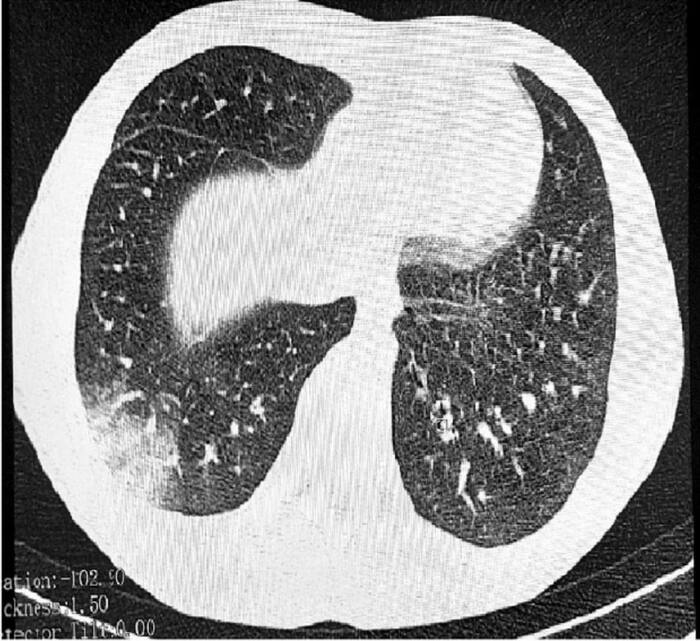 Вейп перешёл на новый уровень опасности