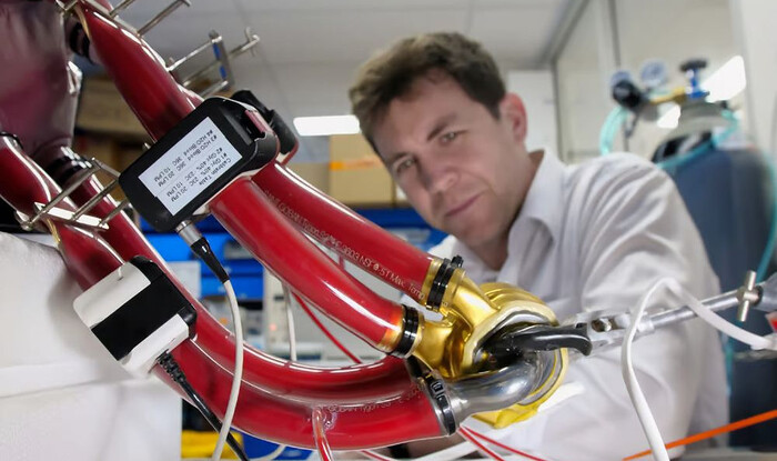 Человек впервые в мире прожил 100 дней с титановым сердцем и выписался из больницы