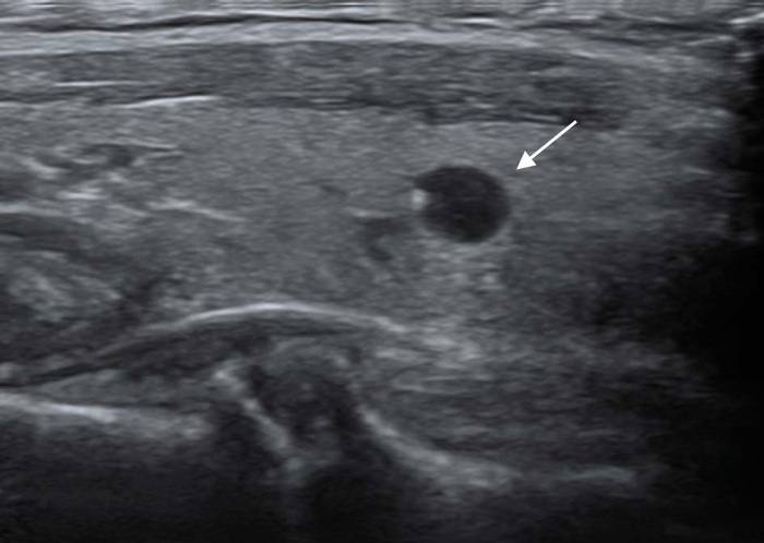 ���-�� ������� �� �������������