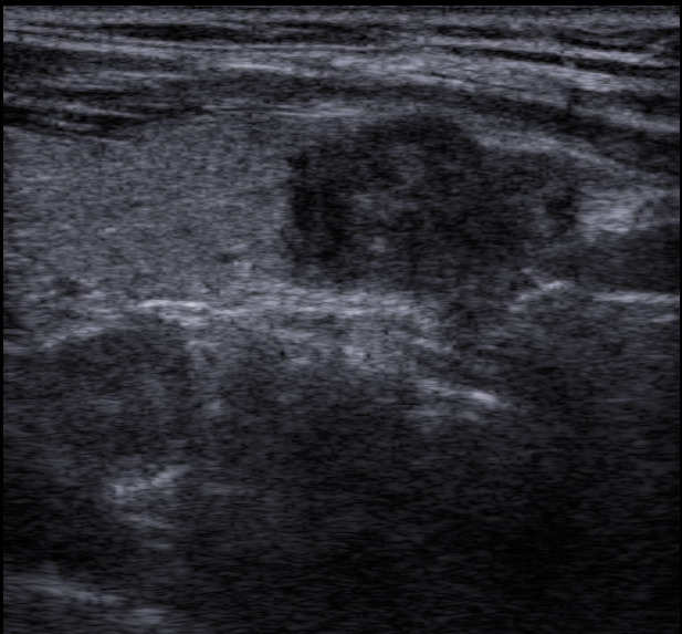 ���� �������