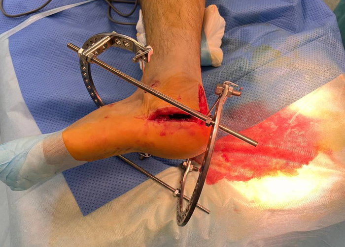 ������� ��� ��������� ��������������� ��������. ��������� �������� �����-�����. ���������� ������� ������ ����������. ��� ����� ������������� ������� � ����������� ����� ����� �������� ���� �������������� �����.