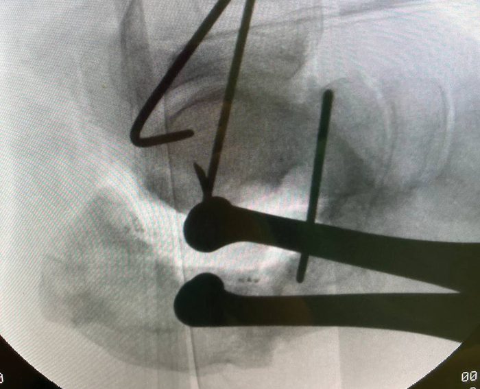 ������� ������� ������ �� L-��������� �������. ���������� ������������ ������ ����� �����, ��� ������������� ��� ���������� � ��������. �.�. ��� ��������� ���� �� ������������� ����������� �������� �� ������, ������ ���� �������