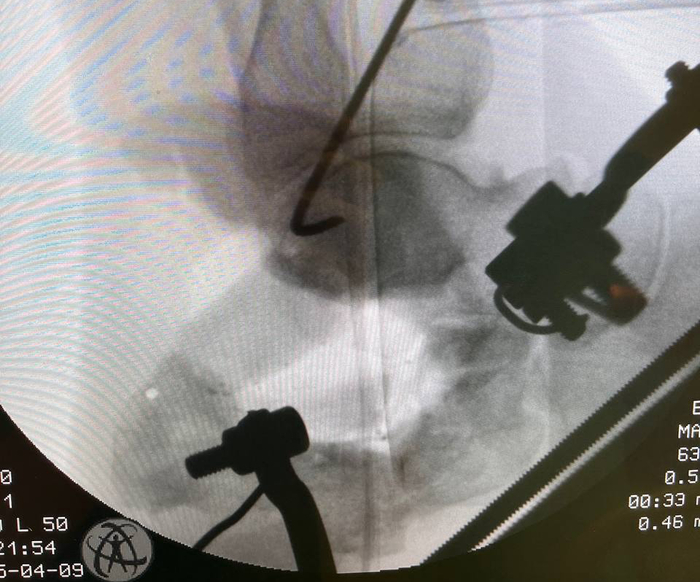 ���-�������� ��������� �������������. ������ �������� ��������, ��� ������������� ���������� ������ ��� ���� �� ������������� �������.