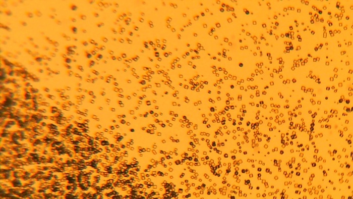 Увеличение х200, нижняя подсветка, раствор