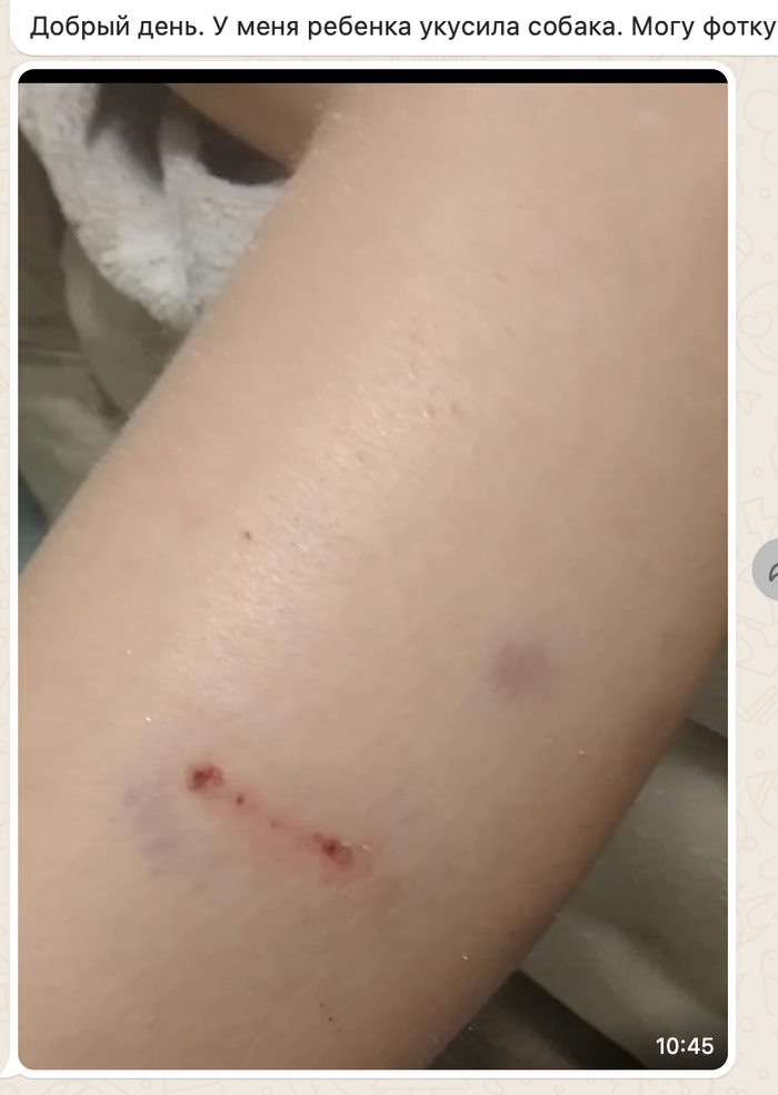 ������ �������, �������� �������