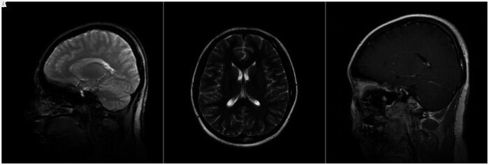 Figure 3. (A, B,  C) -   ( 2018 .) ,         .