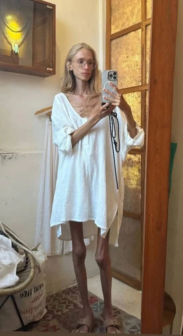 На Бали умерла 27-летняя веганша