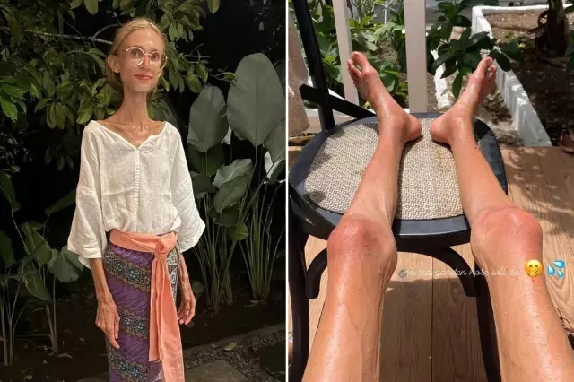 Уже вторая. Веганка на Бали умерла от истощения