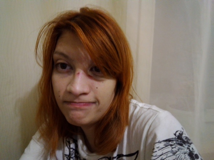 Ответ на пост «Какую травму вы получили по собственной глупости»