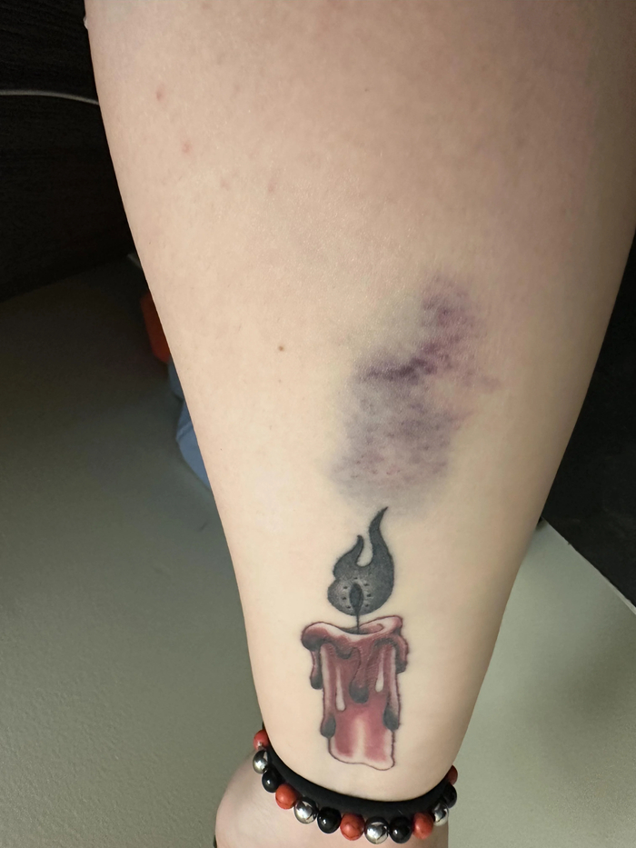 Случайный синяк выглядит как часть татуировки