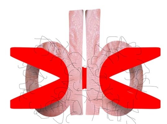 Вариация логотипа сервиса идей для свиданий (нет).