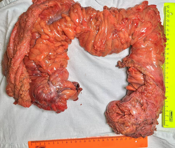 Внешне непонятно, что тут и где.