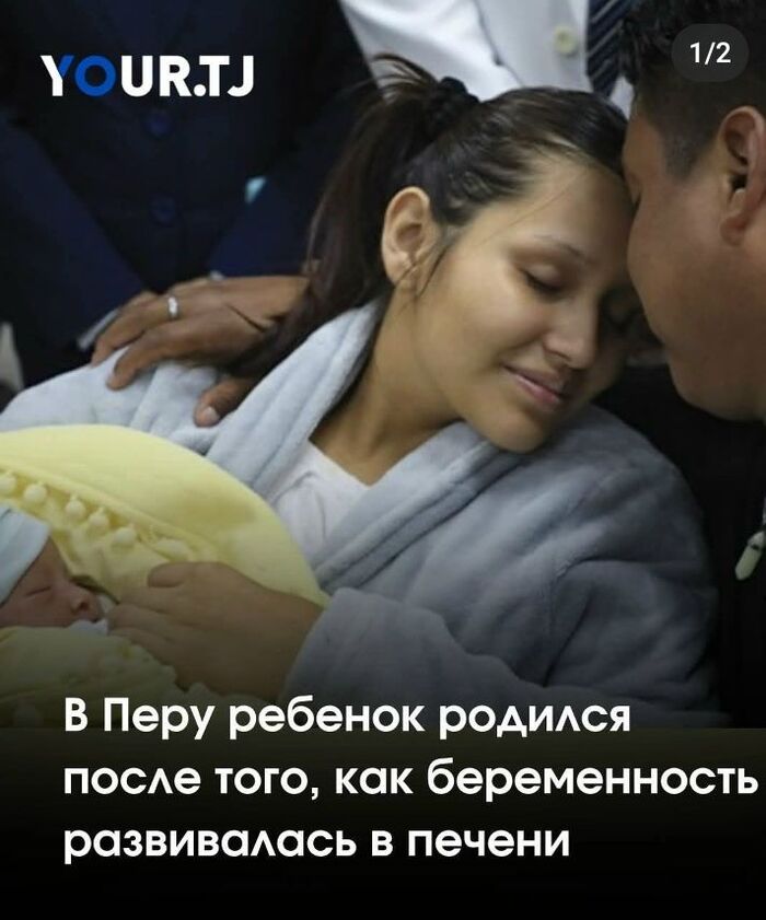 В Перу врачи сообщили об уникальном случае: