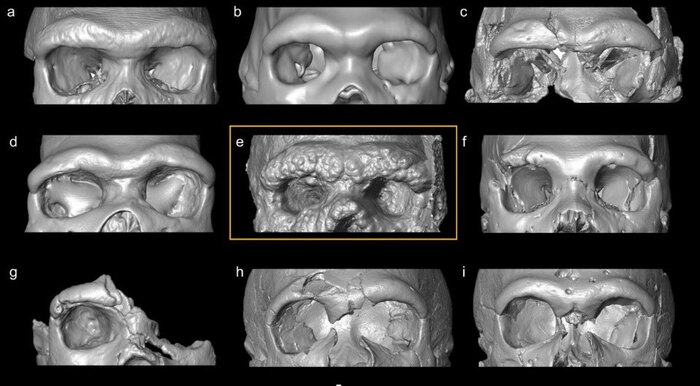 Посередине виден этот череп в сравнении с другими находками.