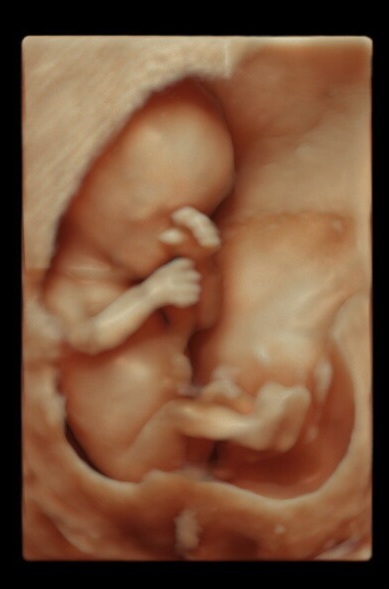 ������ ���������� ����� ���� ��� ����