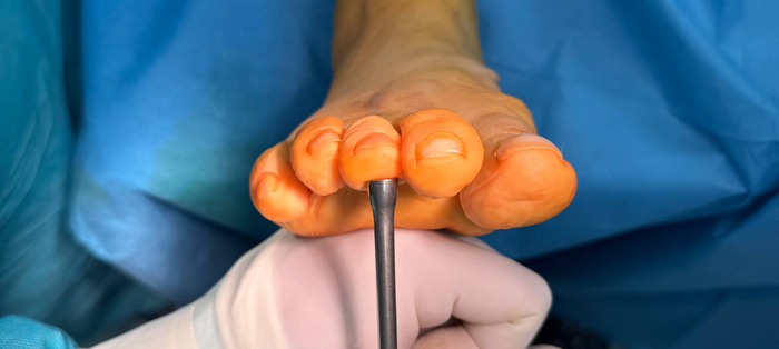 �������� �������� ������ � ��������� 2 � 4.