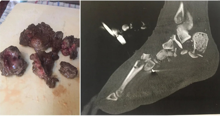 ���� �� ����