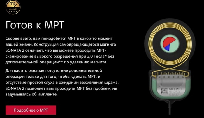 ���� � ������������ ����� �������� MED-EL, <!--noindex--><a href="https://pikabu.ru/story/kokhlearnaya_implantatsiya_v_kieve_moy_opyit_chast_2_13527882?u=https%3A%2F%2Fwww.medel.com%2Fhearing-solutions%2Fcochlear-implants%2Fsonata2&t=https%3A%2F%2Fwww.medel.com%2Fhearing-solutions%2Fcochlear-implants%2Fso...&h=3831930183ad68ff9661224093148323dcf3471e" title="https://www.medel.com/hearing-solutions/cochlear-implants/sonata2" target="_blank" rel="nofollow noopener">https://www.medel.com/hearing-solutions/cochlear-implants/so...</a><!--/noindex-->