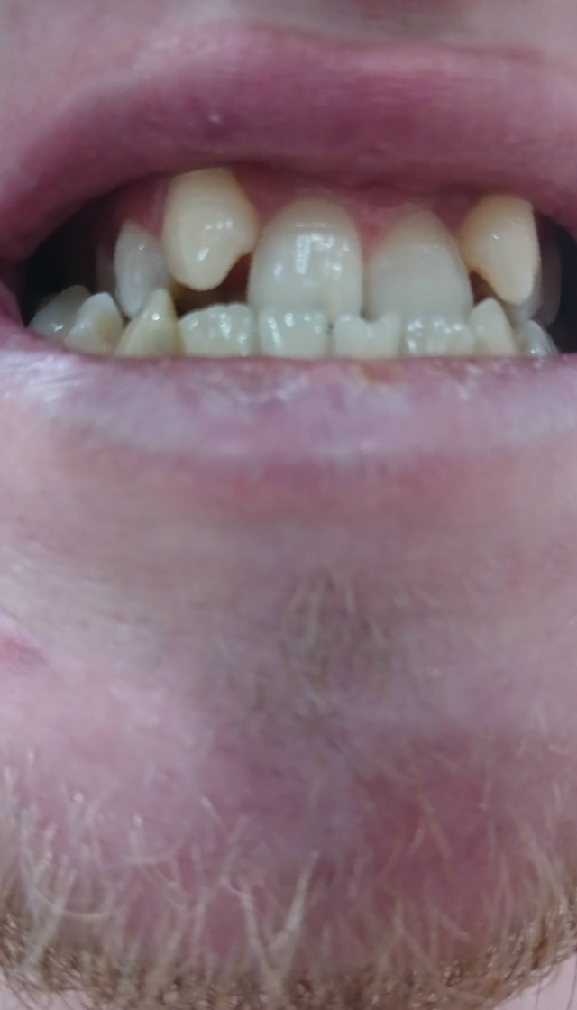 Это то, как было. До операции и активации дистрактора