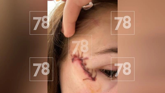 ������ �������. ���� � Telegram / 78 | �������