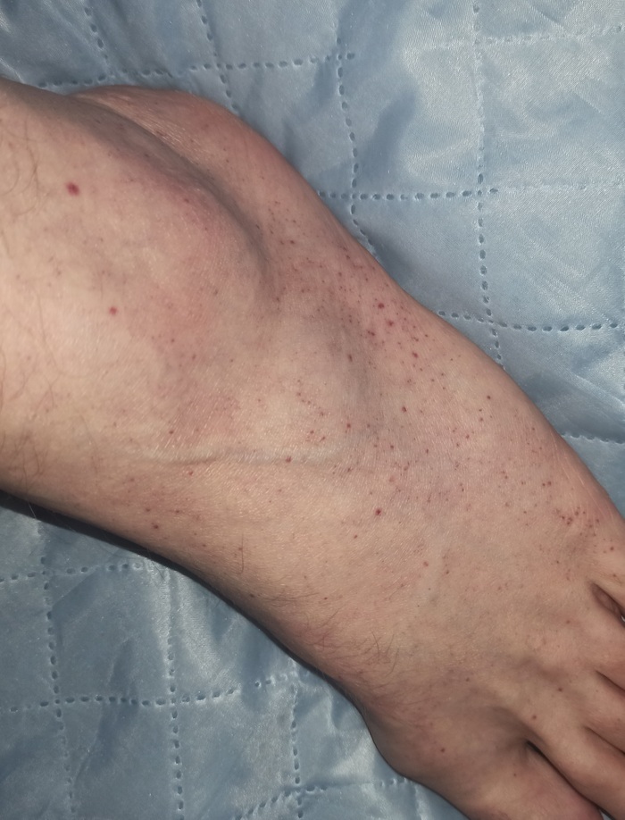 ������� ����� �� �����