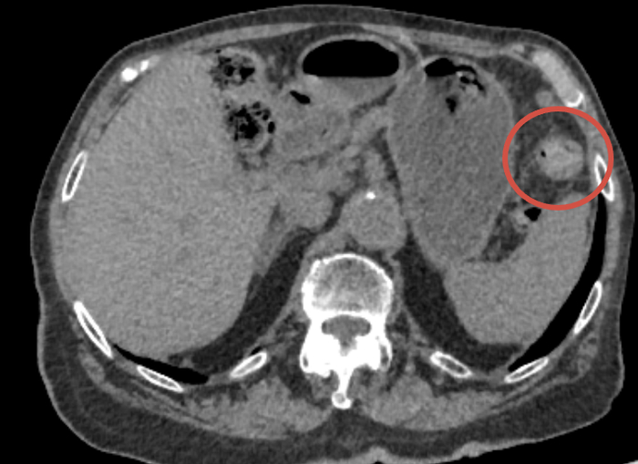 Вот эта мелкая гадость