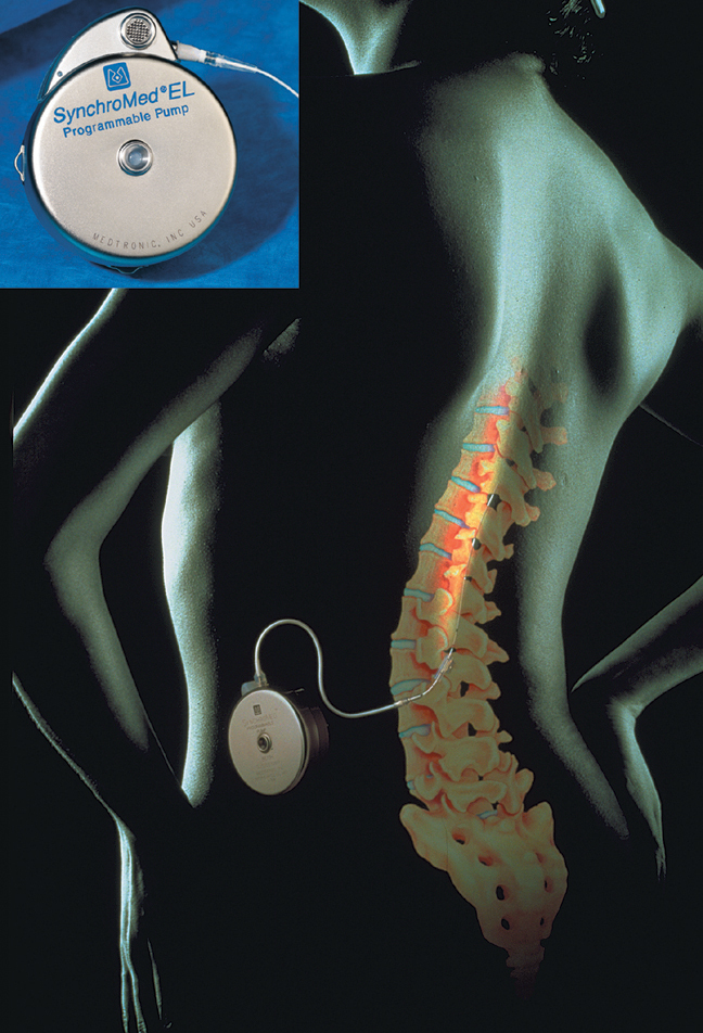 �������������� �����