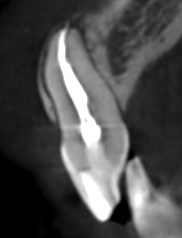 ����� ��������������� ��������� �� �������� ����� ���� � ����