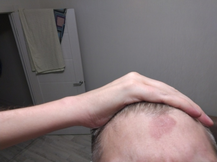 К дермотологам вопрос