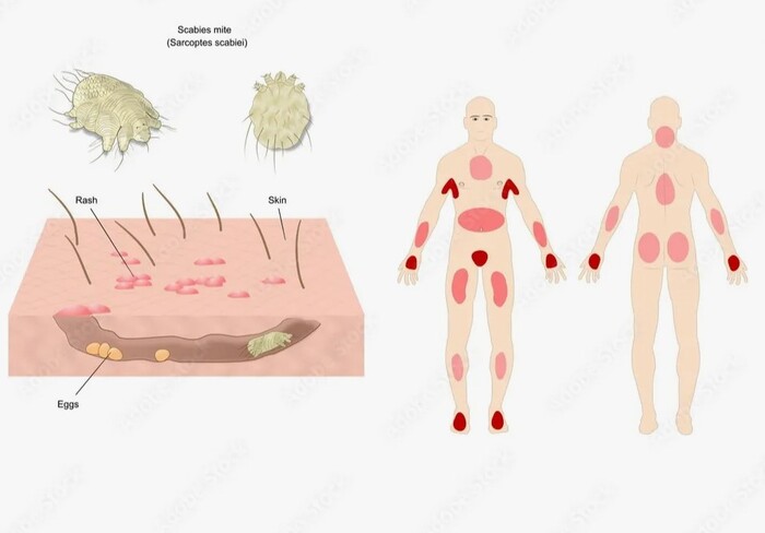 �� ������� ���� ��������� ����. ���������� ������