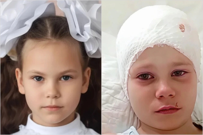 Кроха лежала на земле, как комочек: овчарка сняла скальп с девочки, но хозяйку зверя оставили на свободе