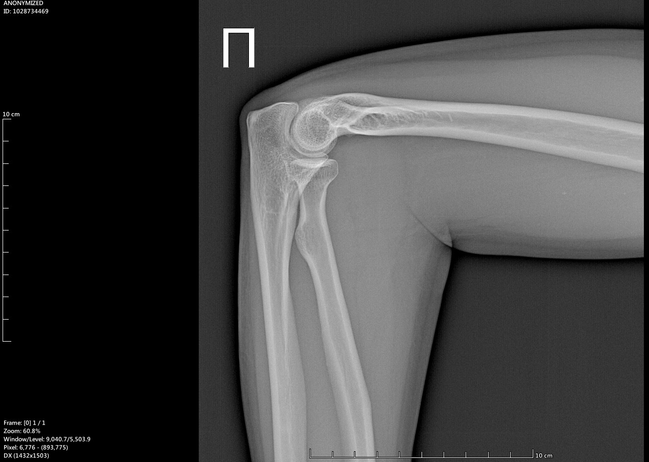 Need medical help! - My, Injury, The patients, Disease history, Arthrosis, Longpost