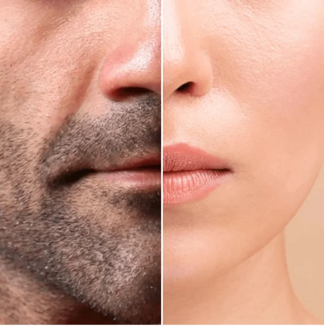 What do brutal men do at the beautician's? - Health, Cosmetology, Care, Dermatology, Botox, Fillers, Laser, Company Blogs, Longpost, 