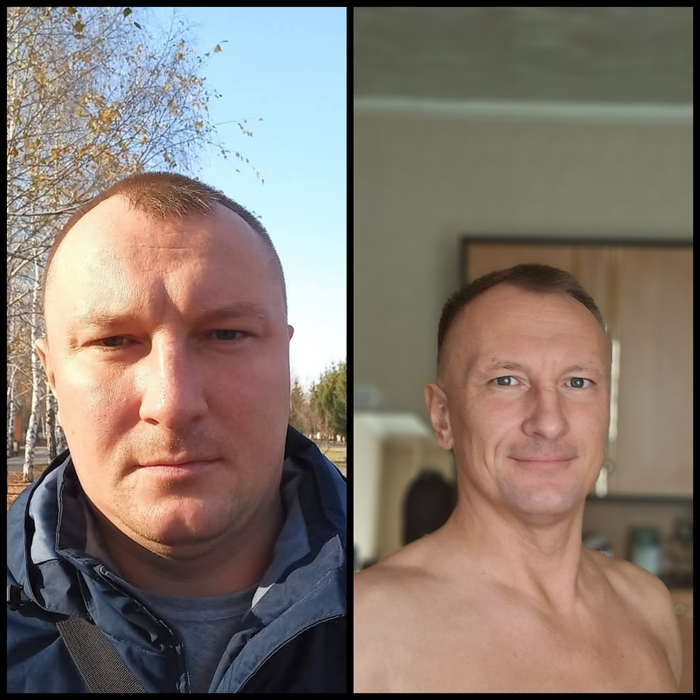 Дескуфизация (36 лет/42 года)