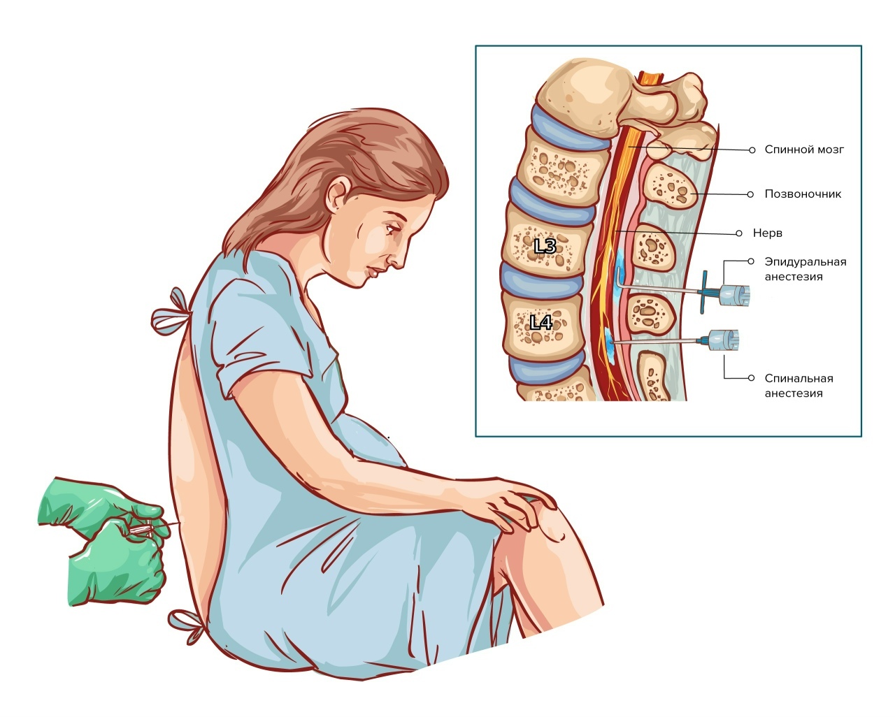 The most common myths about anesthesia - My, Treatment, Surgery, The medicine, Health, Anesthesia, Operation, Narcosis, Longpost