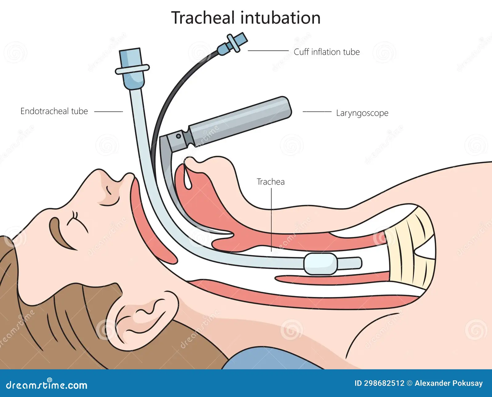 The most common myths about anesthesia - My, Treatment, Surgery, The medicine, Health, Anesthesia, Operation, Narcosis, Longpost