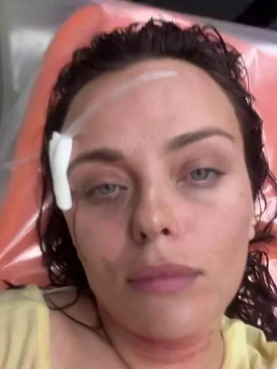 Sober this time. A beautiful blogger from Yekaterinburg crashed her scooter, with blood gushing from her head. - Series Articles from the web, Negative, Incident, Injury, Electric scooter, Scooters, Kick scooter, Yekaterinburg, Longpost