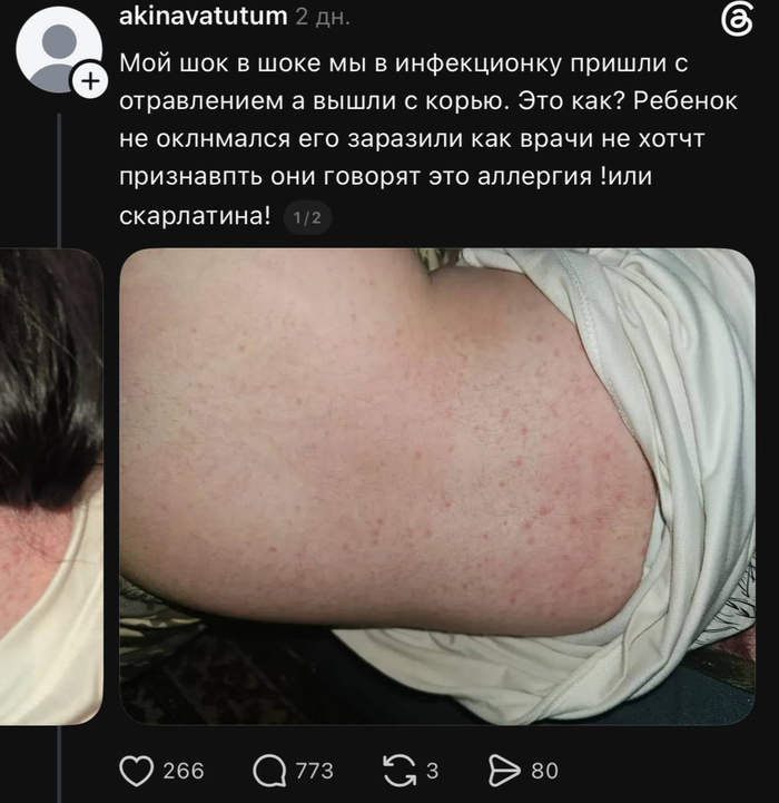 Единичные пятна или папулы - по фото непонятно, равномерно по всей поверхности спины.