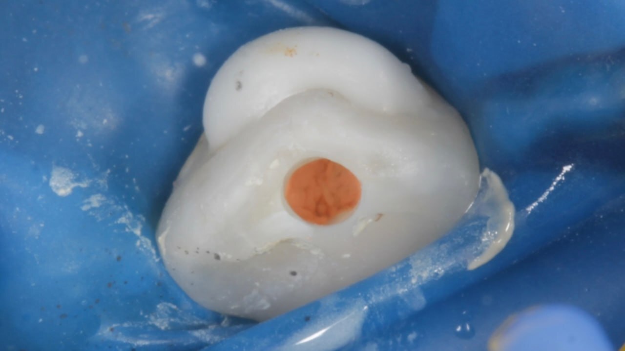 An 8-year-old female patient was referred by a colleague from St. Petersburg. - Dentistry, Teeth, Doctors, Health