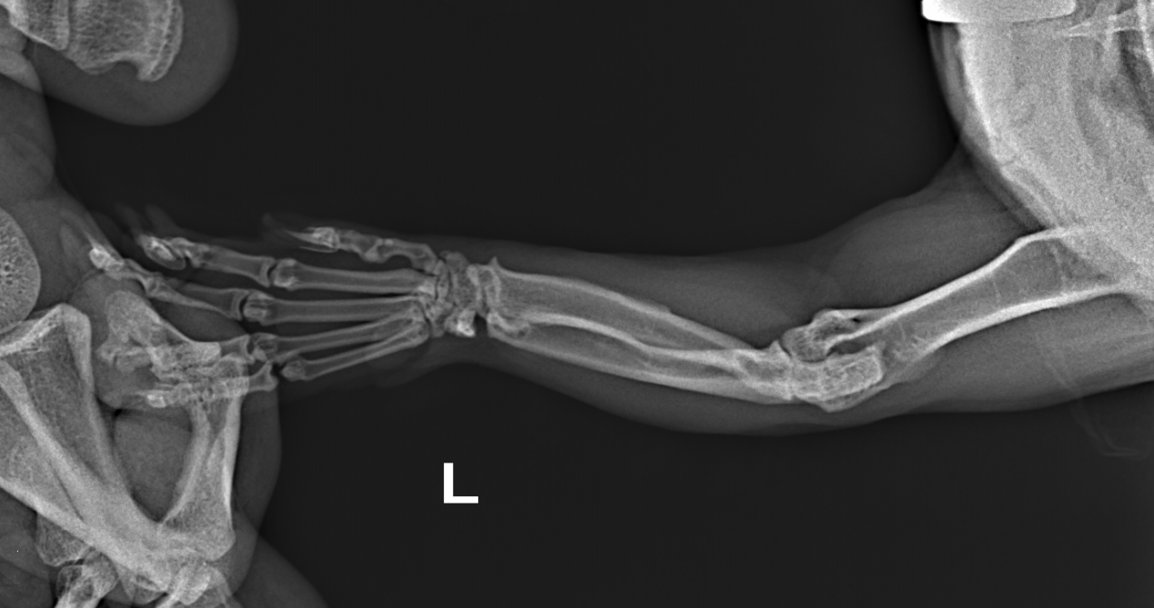 Munchkin cat. Elbow fracture. - My, Injury, Veterinary, Disease history, Animals, cat, Fracture, Treatment, Disease, Pets