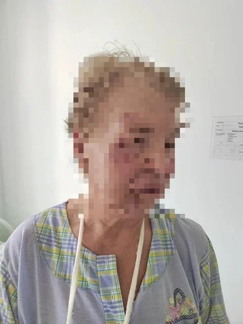 She was lying unconscious in a pool of blood: Teenagers on an electric scooter hit a woman in the Southwest - Series Articles from the web, Negative, Incident, Teenagers, Kick scooter, Scooters, Electric scooter, Yekaterinburg, Police, Injury, Longpost