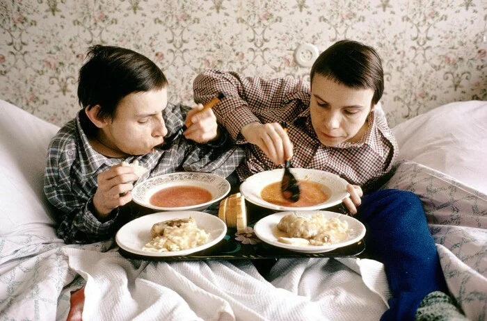 One Life for Two: The Story of the USSR's Most Famous Siamese Twins, Masha and Dasha Krivoshlyapov - Siamese twins, the USSR, Girls, The medicine, Disease history, Disease, Medics, Operation, Surgery, Hospital, The patients, Treatment, Doctors, Ambulance, Disabled person, Negative, Zen, Yandex Zen, Longpost, Yandex Zen (link)