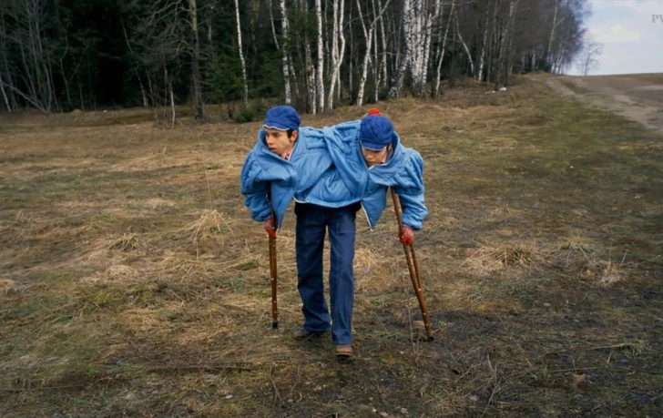 One Life for Two: The Story of the USSR's Most Famous Siamese Twins, Masha and Dasha Krivoshlyapov - Siamese twins, the USSR, Girls, The medicine, Disease history, Disease, Medics, Operation, Surgery, Hospital, The patients, Treatment, Doctors, Ambulance, Disabled person, Negative, Zen, Yandex Zen, Longpost, Yandex Zen (link)