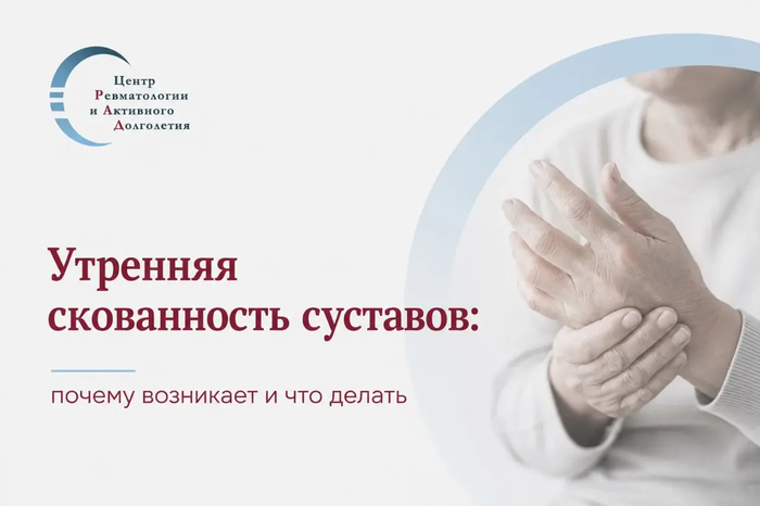 Утренняя скованность суставов: почему возникает и что делать